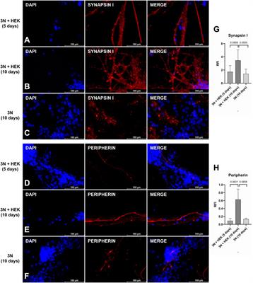 Differentiation of peripheral sensory neurons from iPSCs derived from stem cells from human exfoliated deciduous teeth (SHED)